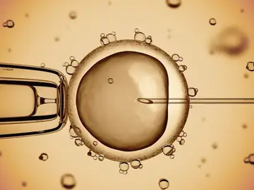 Fertility and IVF